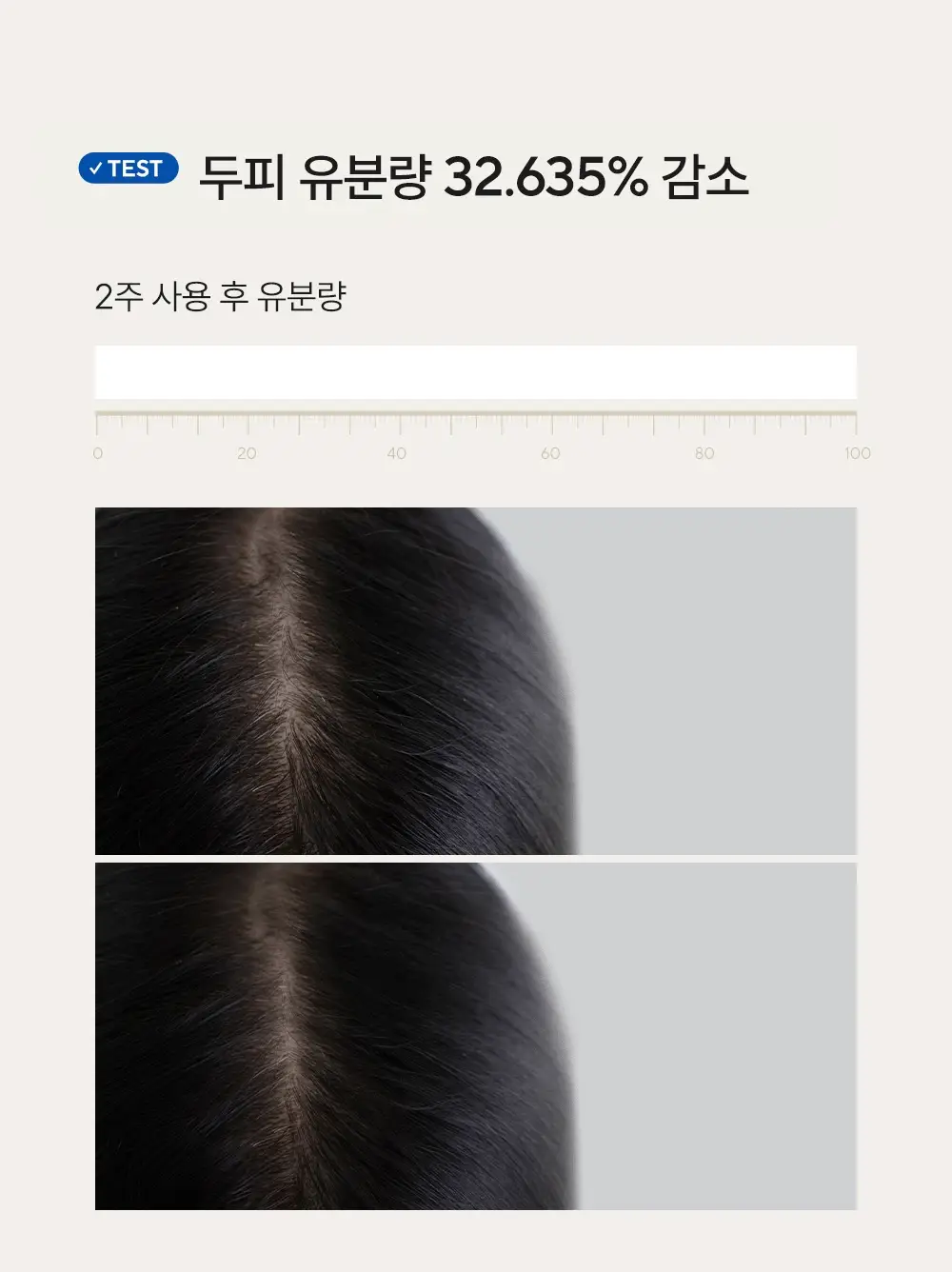 [두피쿨링/탈모증상완화] 아로마티카 티트리 퓨리파잉 토닉 100ml (단품/더블기획) 상세페이지 22